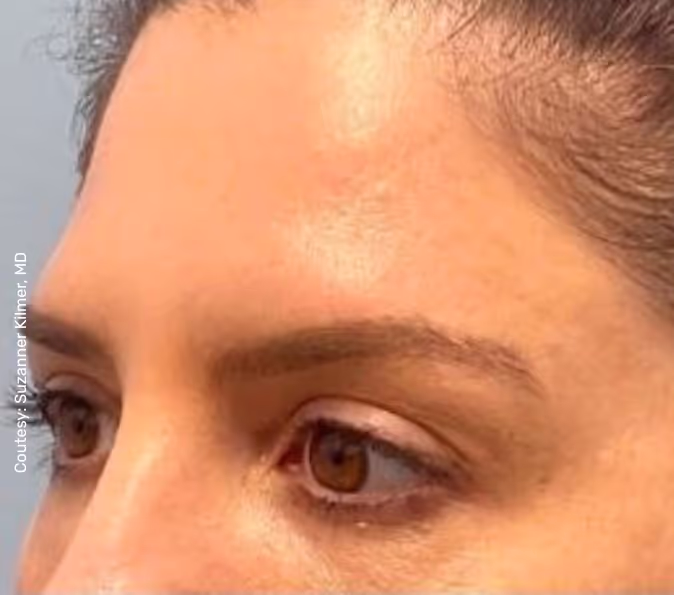 תמונה של אישה לפני הטיפול