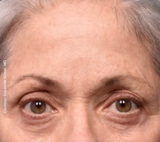 תמונה של אישה אחרי הטיפול